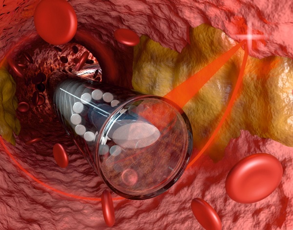 Ультратонкая волоконно-оптическая система может заглянуть внутрь кровеносных сосудов